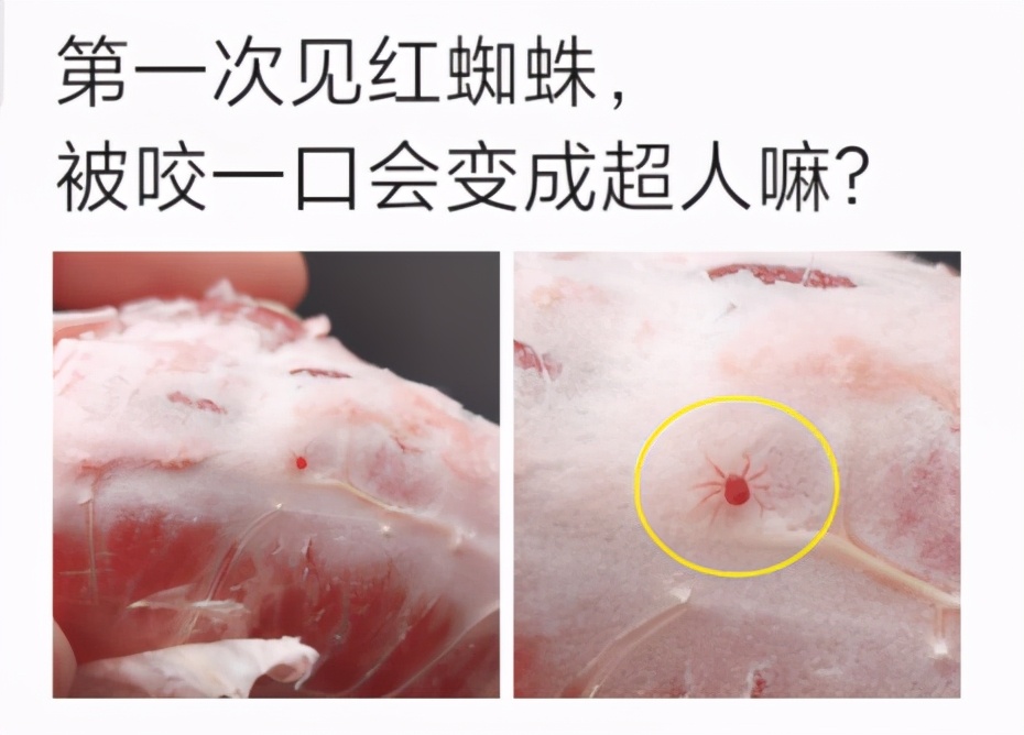 第一次见嘴巴被蚊子咬肿,如果被毒蜘蛛咬一口就会变成蜘蛛
