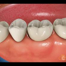 牙科行业有哪几种,牙科行业目前的痛点