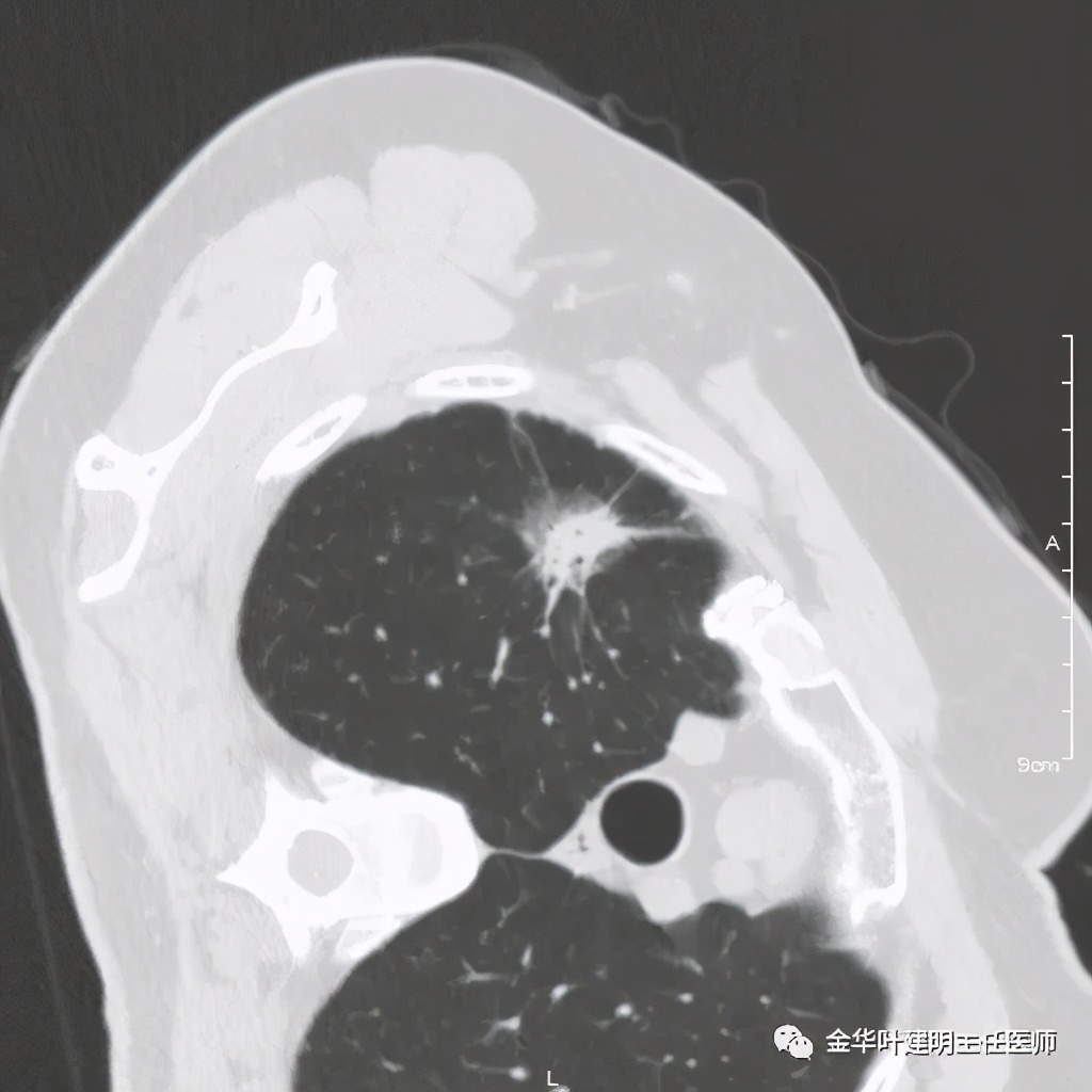 放个大招完整版教学,放个大招完整版前奏