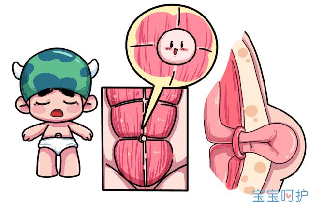 宝宝脐疝多久能自愈,脐疝长了四五年了还有可能自愈吗