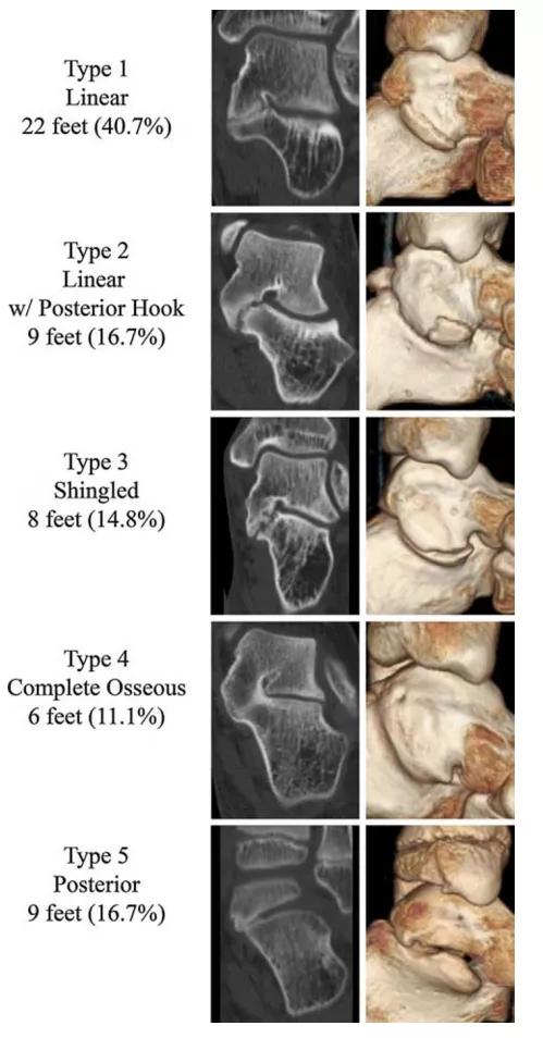 小孩玩多了脚酸脚痛怎么回事,小孩子玩着玩着就脚痛