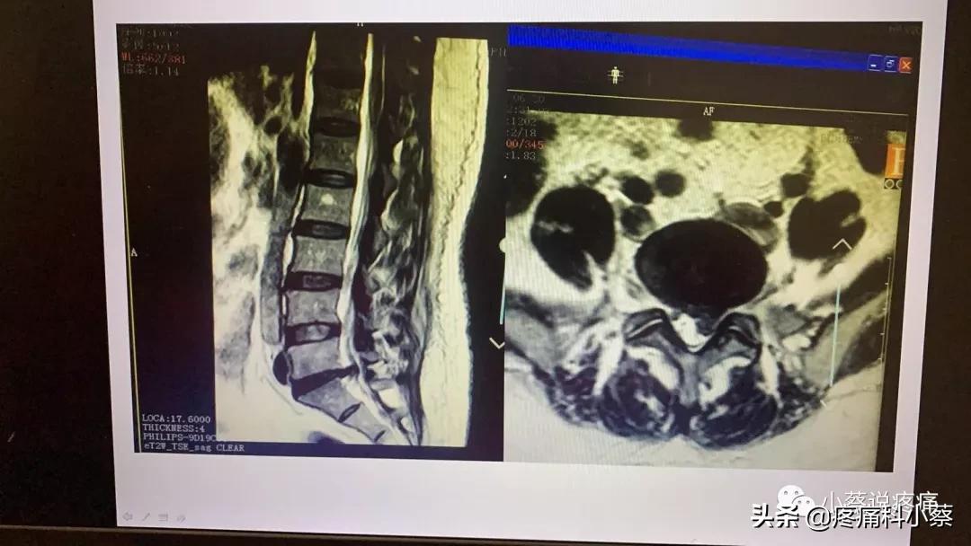 蔡主任讲座视频,蔡主任团队