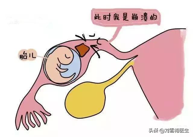怎么知道自己输卵管是否通畅,如何知道输卵管是否通畅