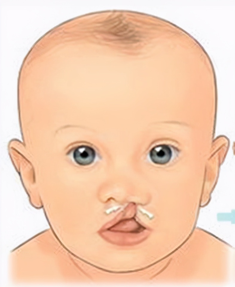 国家免费检查政策——免费孕前优生和婚前检查