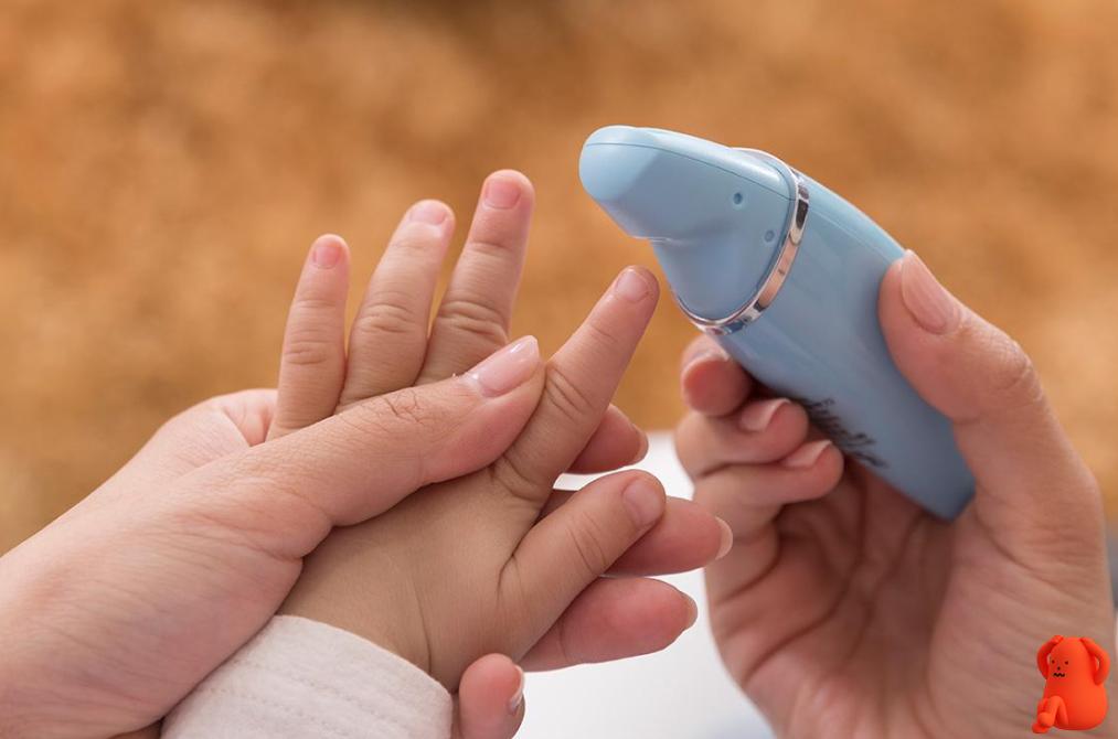 宝宝指甲白是缺什么,宝宝指甲是软的是怎么回事