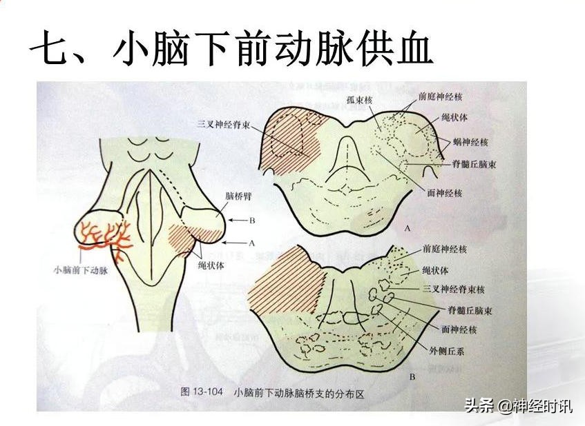 脑动脉解剖学讲解,基底节区脑血管解剖