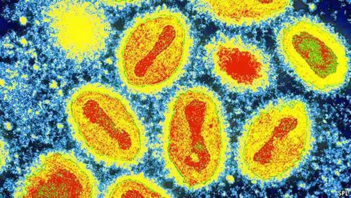 天花病毒如何干掉人类,天花病毒怎么意外消灭的