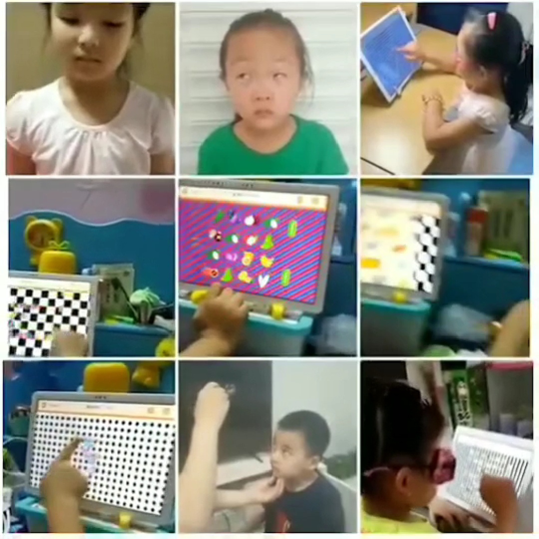 弱视远程训练、弱视可以远程训练了