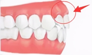 一张嘴毁掉了整张脸,一张嘴毁掉半张脸完整版