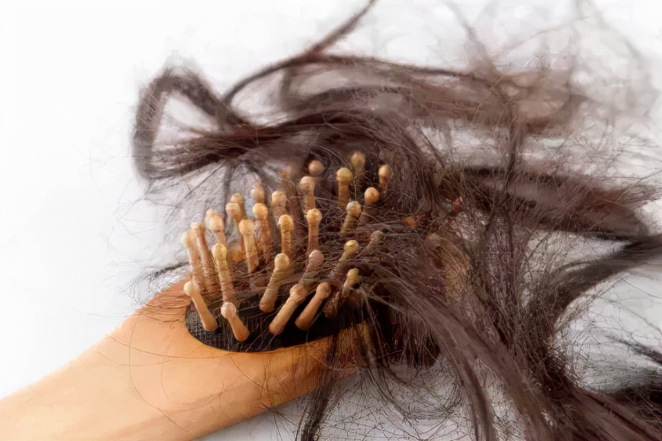 头发后脑勺分界线怎么处理,头发分界线怎么分显瘦