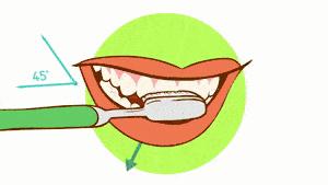 牙釉质受损能自己修复吗,牙釉质损坏有什么补救的吗