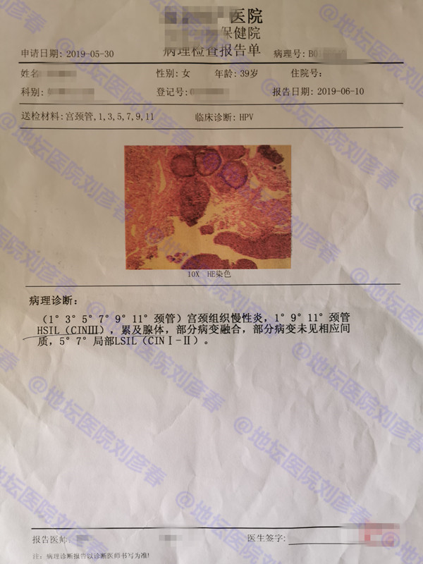 男性hpv16感染怎样治愈,感染hpv16能痊愈吗