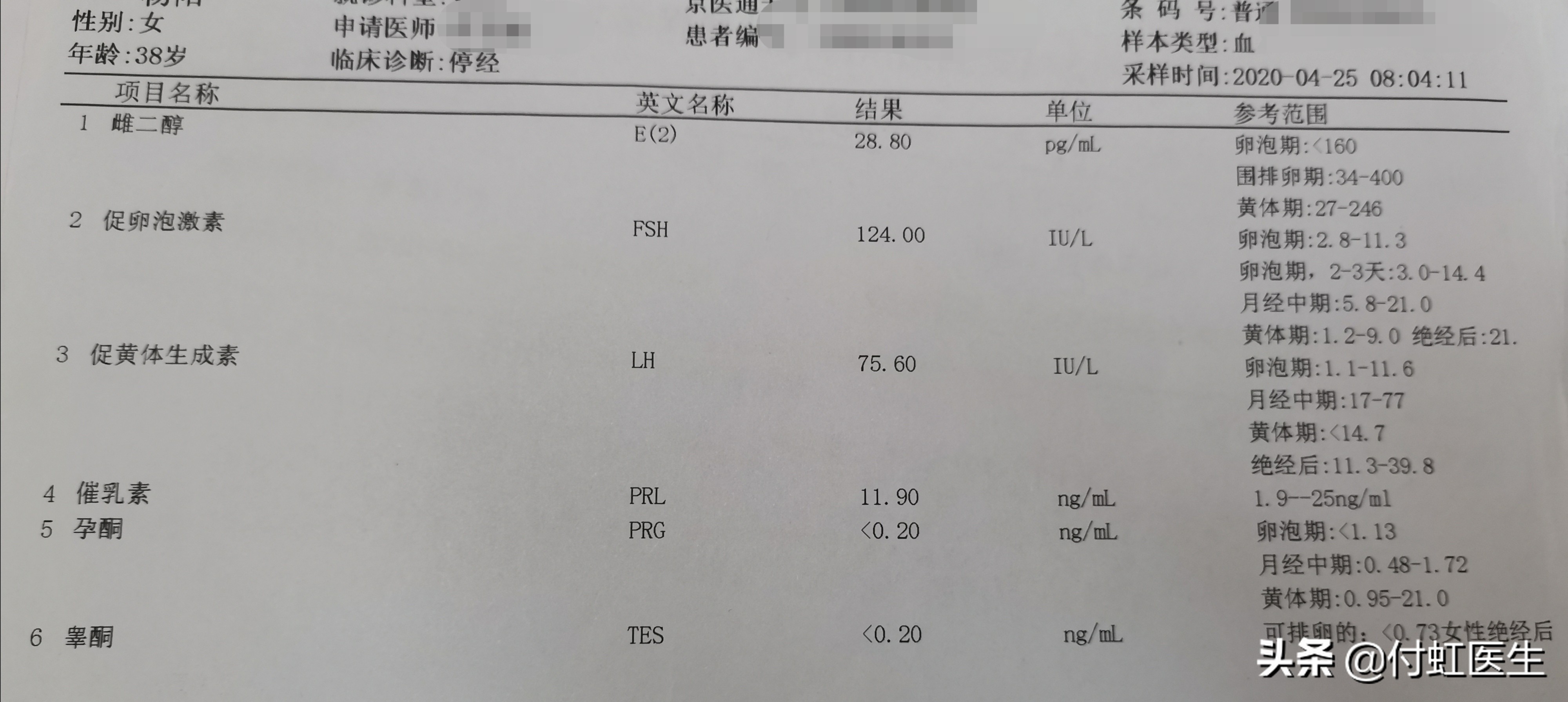 39岁的女人卵巢早衰正常吗,38卵巢早衰停经了影响寿命吗