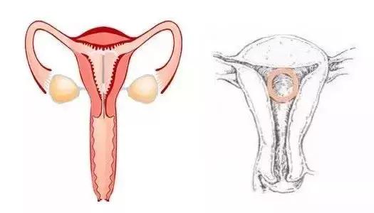 【健康】2600万被遗忘的中国女性，身体里还留着一颗“定时*弹炸**”！