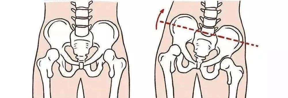 5天极速改善腿型,15天改善腿型的动作
