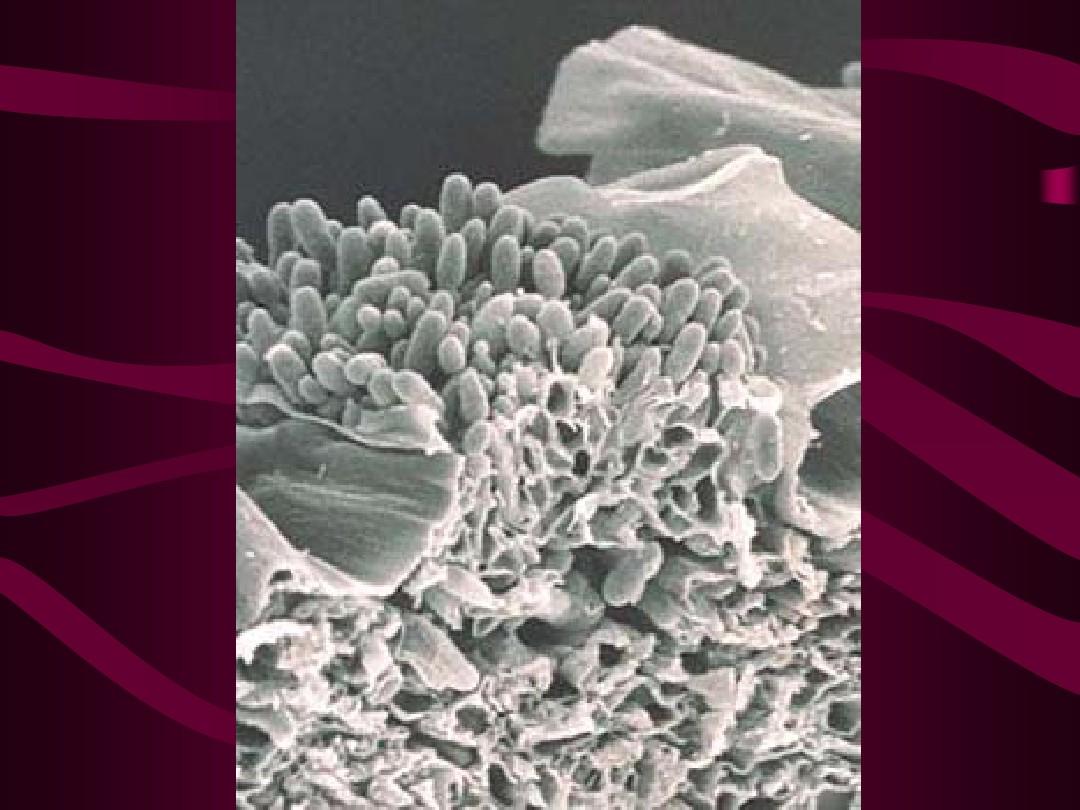 苹果粗皮轮纹病和腐烂病的区别,苹果轮纹病用什么药治疗