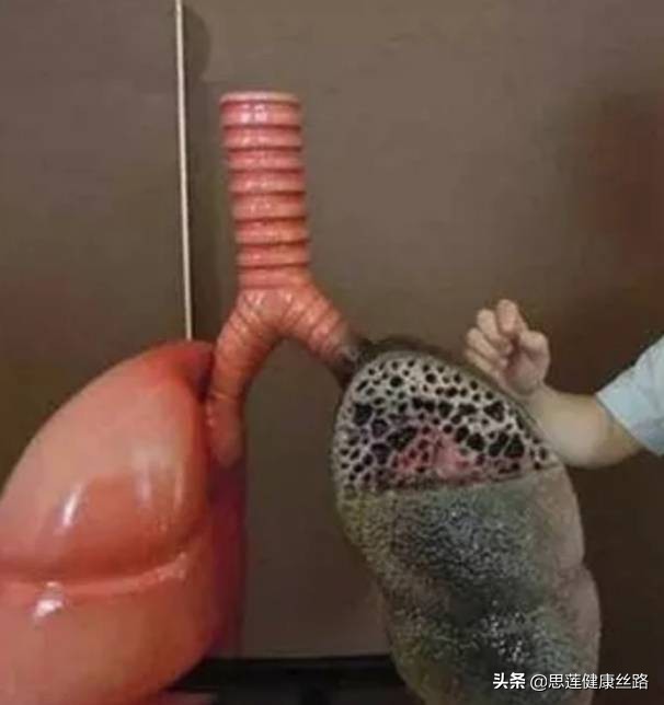 喝百草枯后抢救最佳时间,百草枯喝下去抢救成功案例