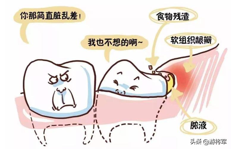 疫情期间怎么预防口腔病,疫情期间哪些口腔问题需及时就诊