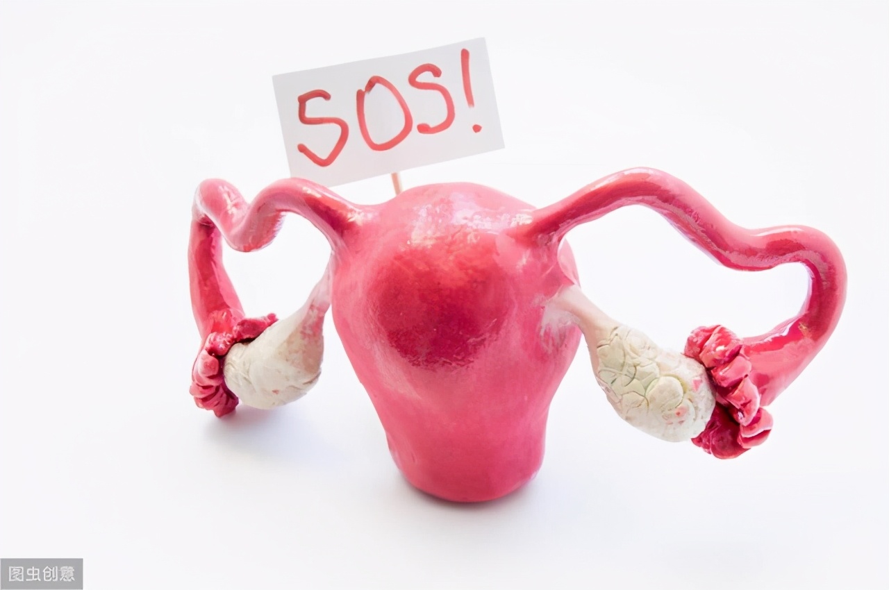 子宫肌瘤有不开刀的病例吗,巨大的子宫肌瘤怎么治疗