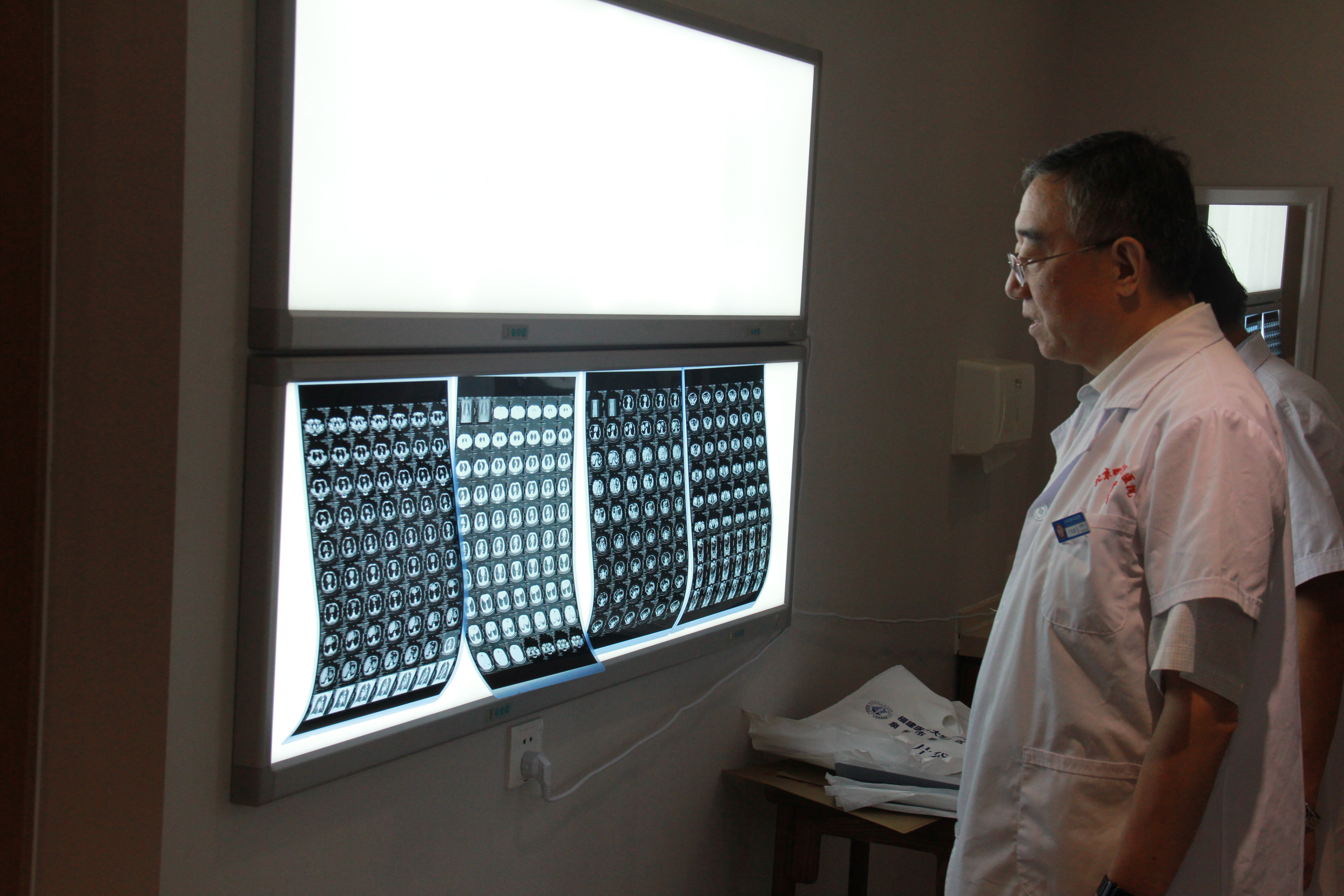 得了胰腺癌去医院什么科室治病,胰腺癌治疗后的康复方法