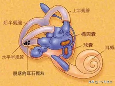 良性阵发性位置性眩晕手法复位,耳源性眩晕症怎么复位