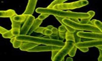 结核通俗讲什么意思,结核概述