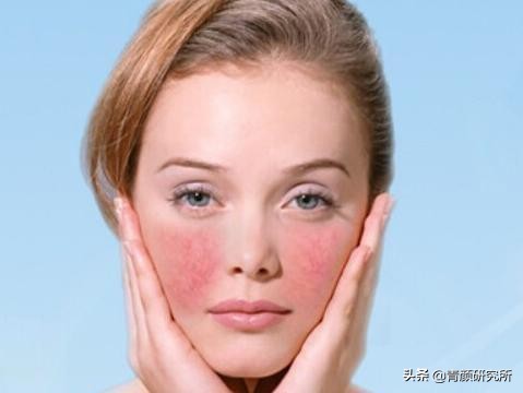 修复角质层薄红血丝敏感肌擦什么,角质层薄红血丝敏感肌肤用什么药