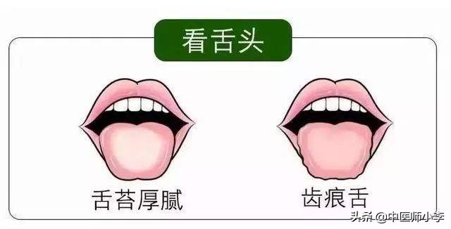 女人湿气重吃什么东西排湿最快,气血不够湿气重的女人该怎么调理