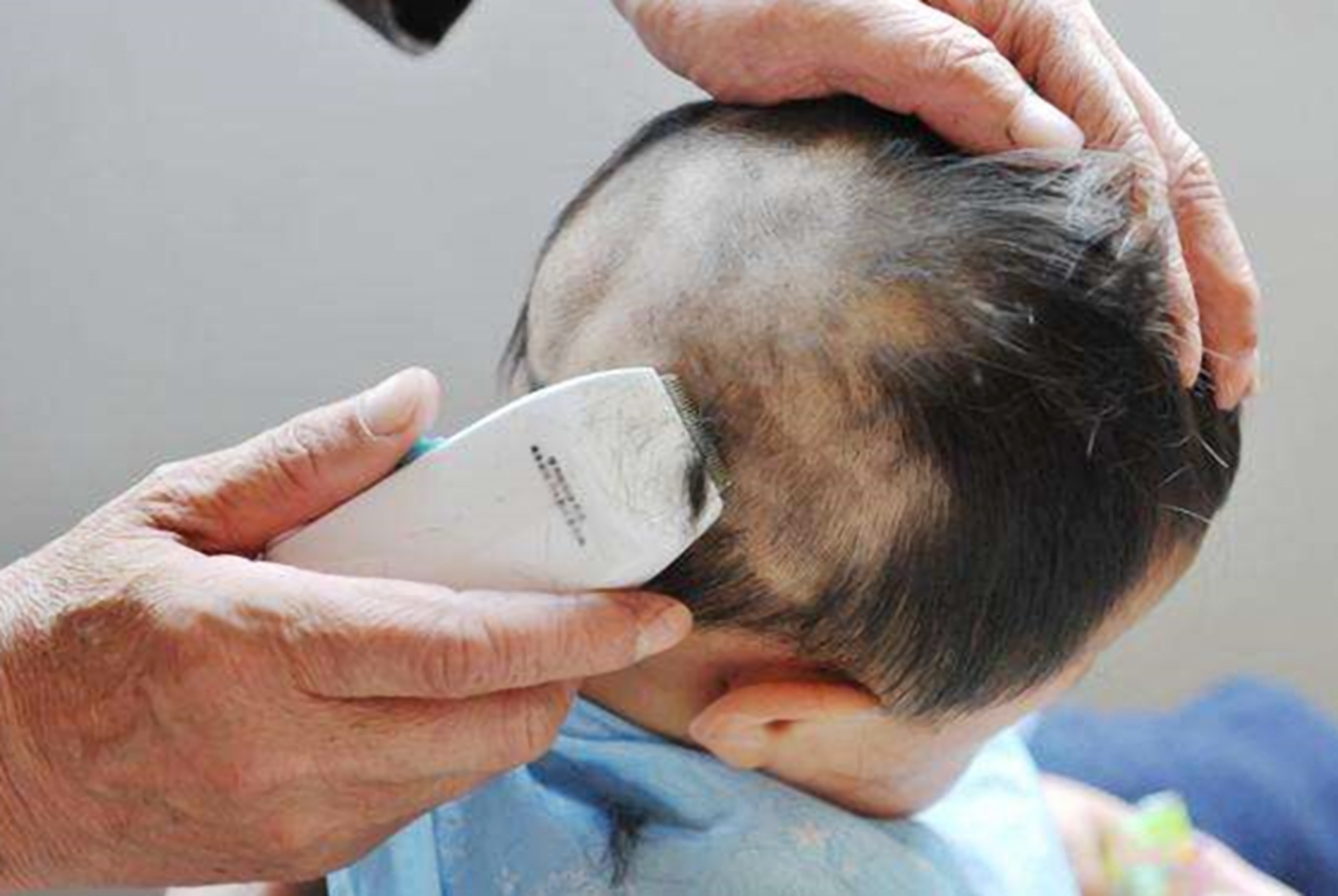 宝宝成为小秃瓢这4个原因要了解,宝宝头发有斑秃是什么原因