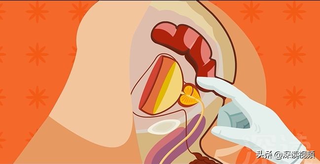 前列腺发炎为什么治不好,前列腺是什么原因所引起的