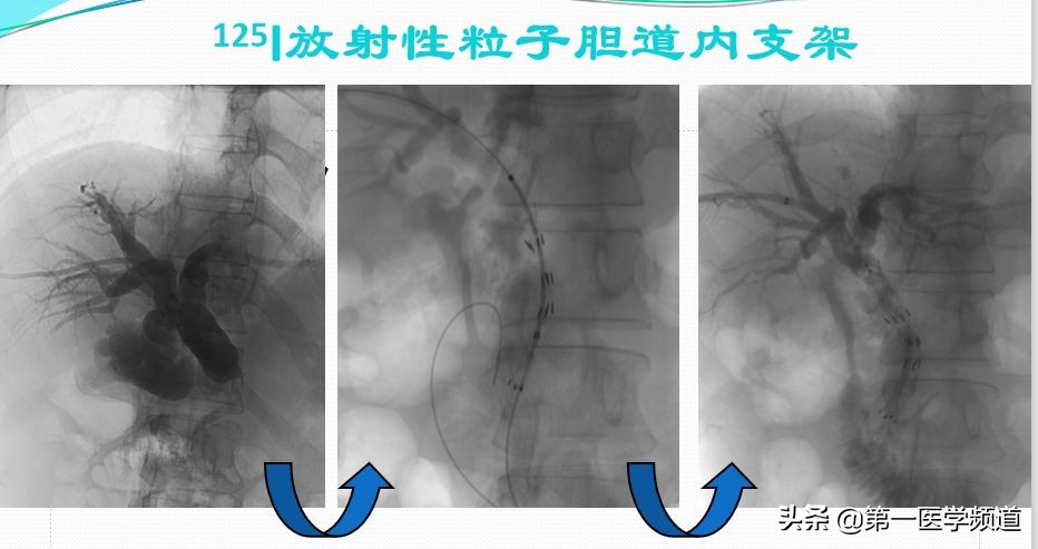 「医影传声」上海交通大学医学院附属瑞金医院卢湾分院放射科主任