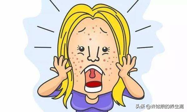 女性毛发旺盛频繁长痘,满脸痘痘内分泌失调怎么调理