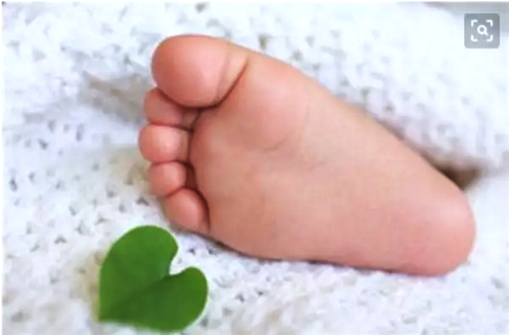 特医婴幼儿食品,苯丙酮尿症特医食品