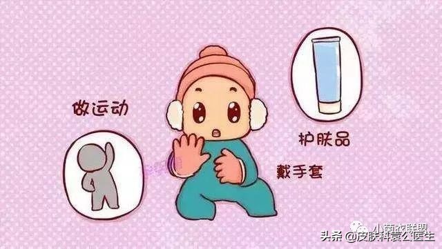 冻疮后期接触水干燥发痒怎么治,冻伤痒痛