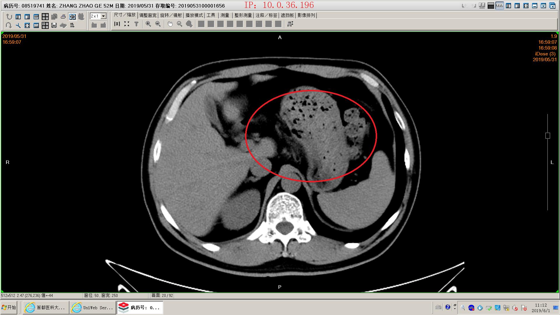 狗得了胰腺炎怎么办,狗得了胰腺炎治疗