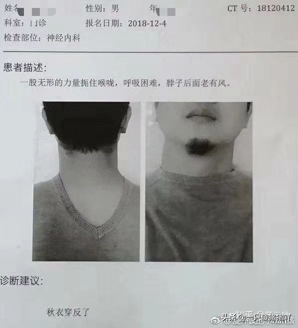 小熊软糖能生发吗,黄色小熊软糖生发