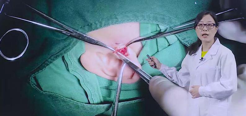 小孩耳朵有小孔好吗,孩子耳朵看富贵命