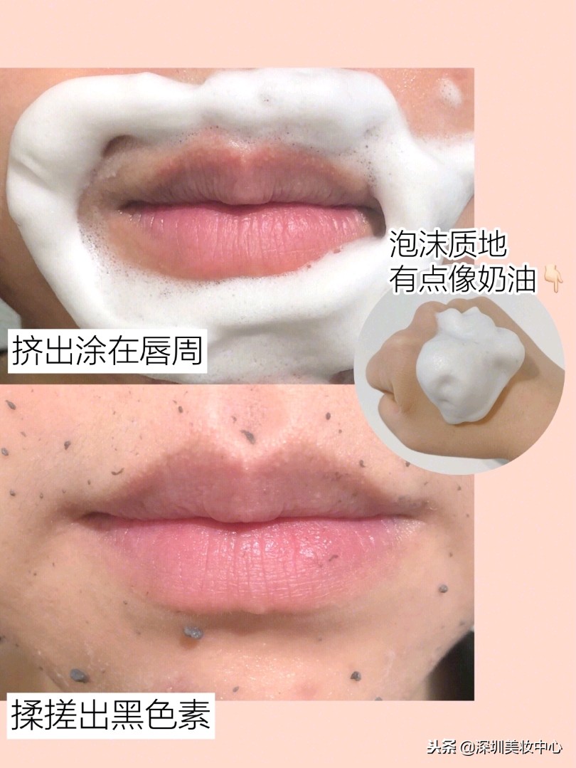 种草：嘴角、唇周围发黑，变白有招，温和不伤肤！