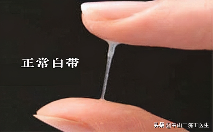 白带健康的晴雨表是什么意思,白带是健康的晴雨表