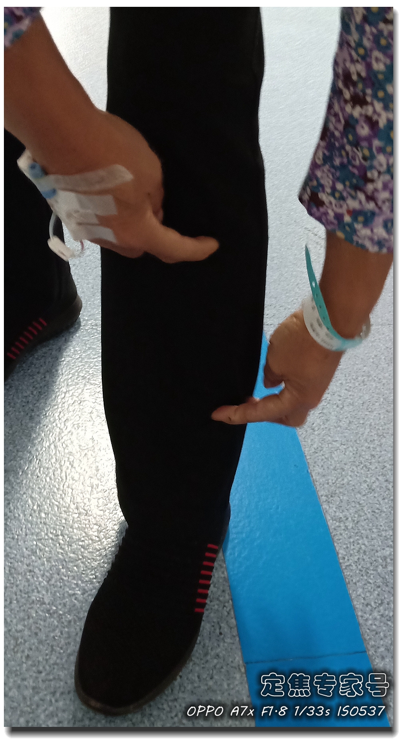 弯腰腰突然抽筋,弯腰时突然腰后侧抽筋