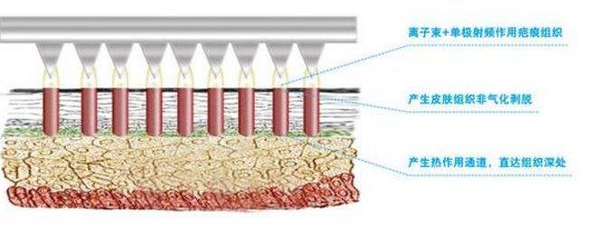 都挺好评分高还是低,都挺好后期
