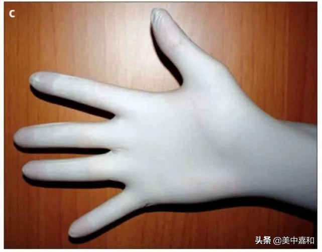 3分钟教你读懂CT检查报告