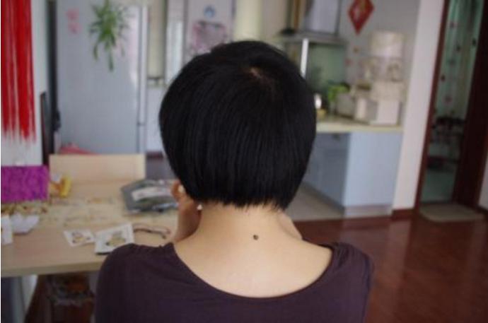 怀孕部位变黑什么原因,怀孕时身体这4个部位变黑了