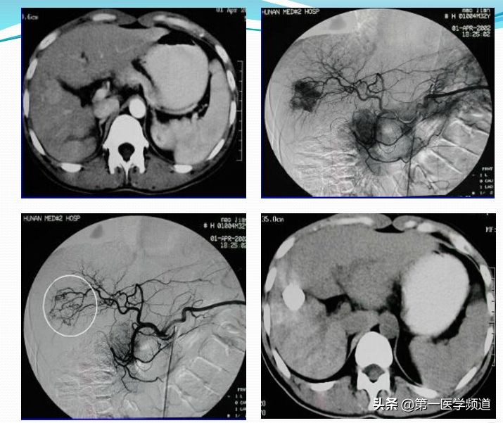「医影传声」上海交通大学医学院附属瑞金医院卢湾分院放射科主任