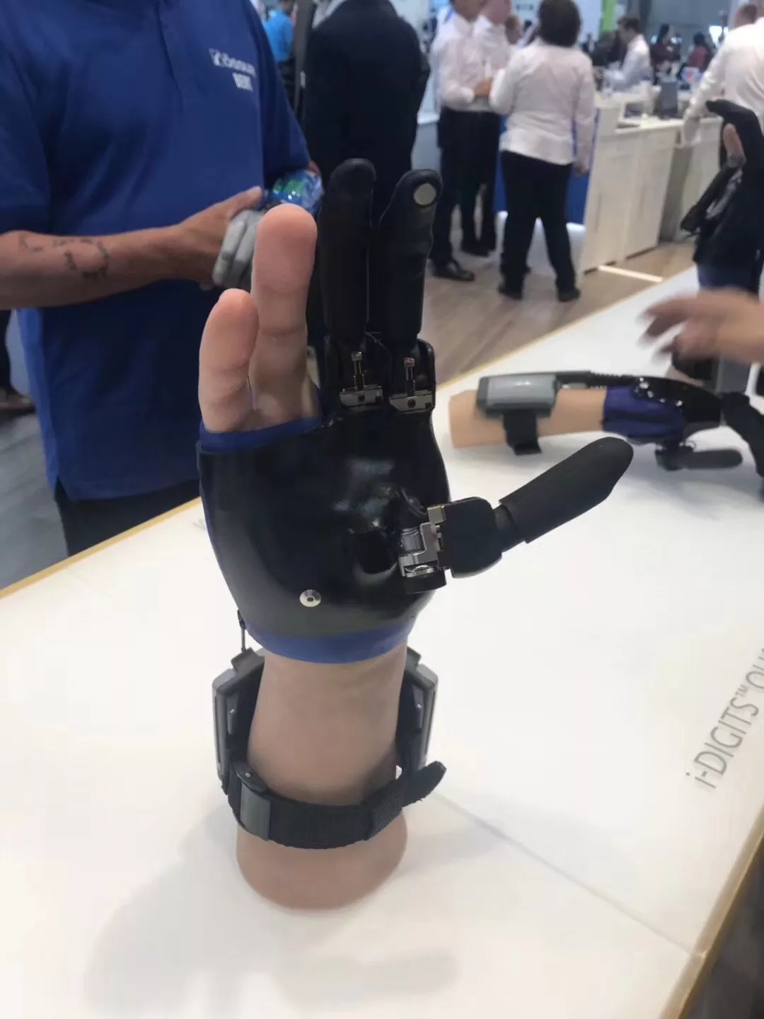 截肢后戴假肢老是疼怎么处理,截肢病人关注事项