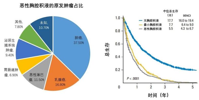 恶性肿瘤胸腔积液严重吗,恶性胸腔积液可以打药吗