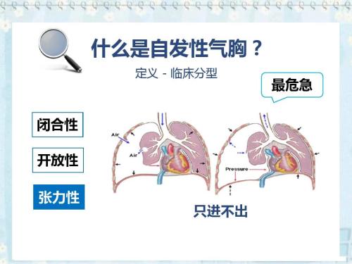 胸痛未必都是冠心病，但是同样不能耽搁