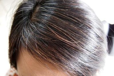 每天这样喝水皮肤越来越好,粉碎哪些护肤谣言