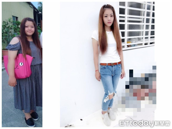 重度肥胖很快减肥后的变化,肥胖引起的心血管疾病