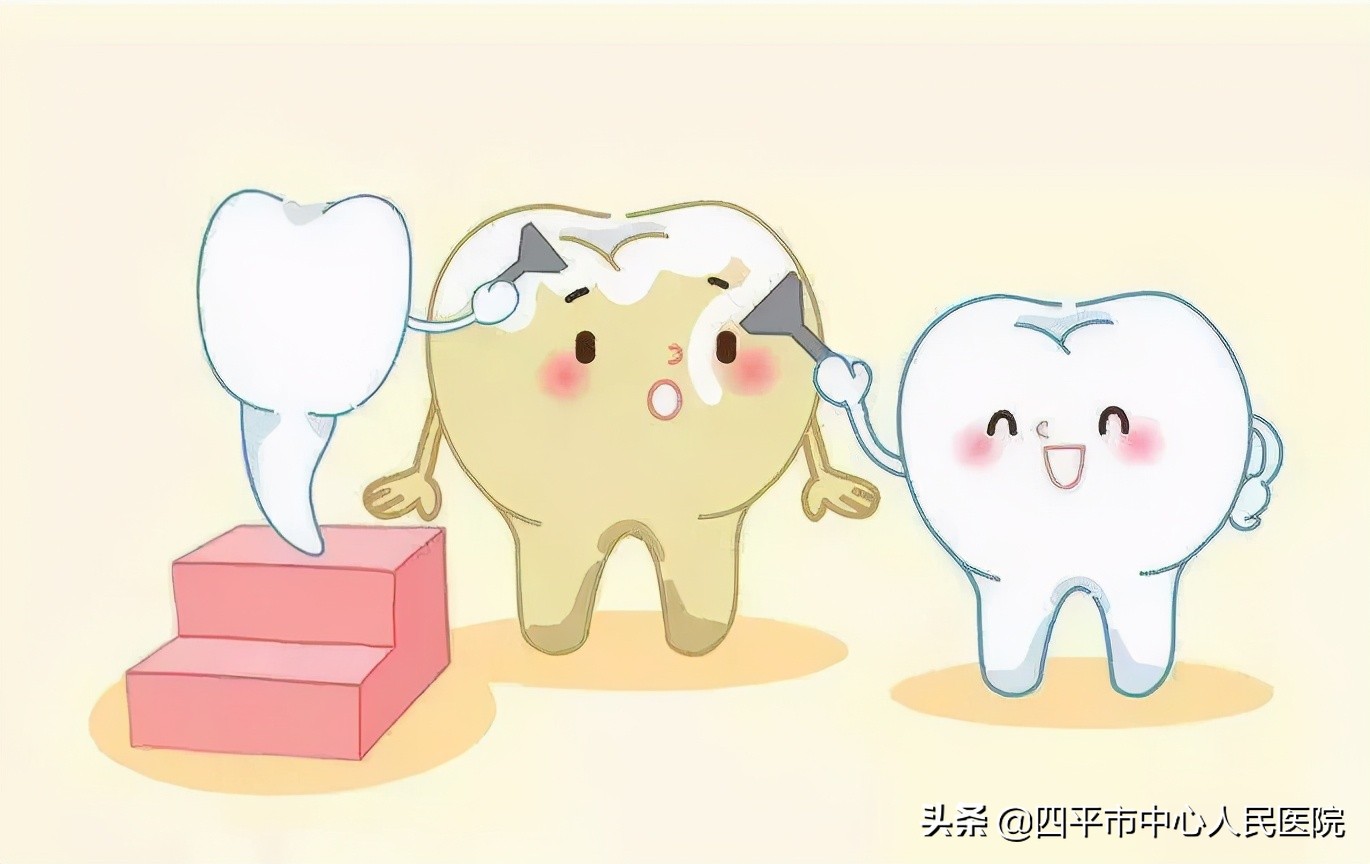 牙结石的危害一般多久会表现出来,牙结石最严重的后果